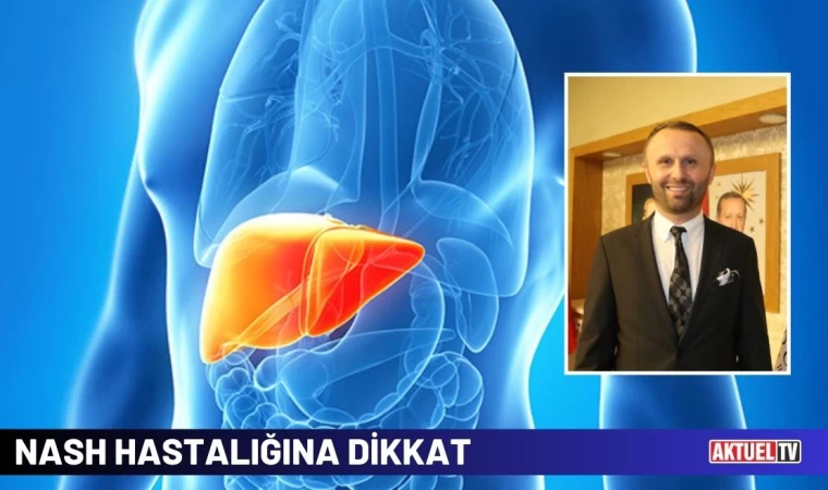 NASH Hastalığına Dikkat