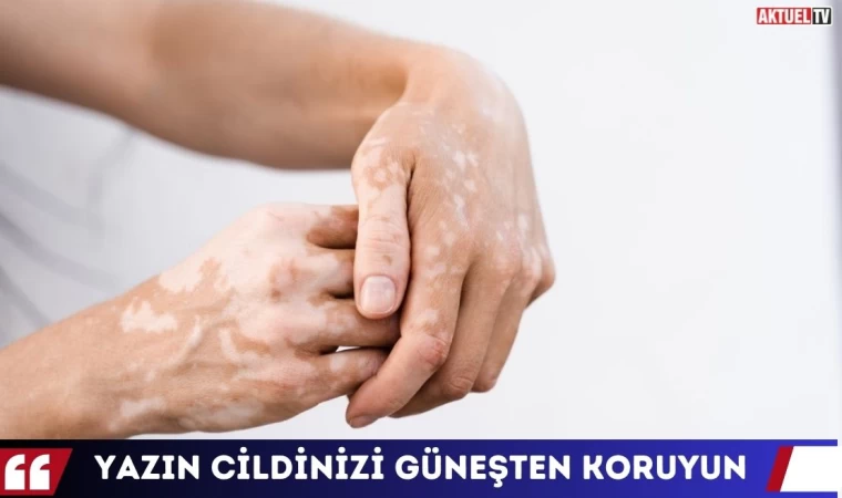 Yazın Cildinizi Güneşten Koruyun