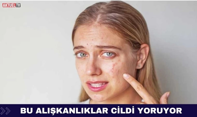 Cildi Yoran Alışkanlıklar