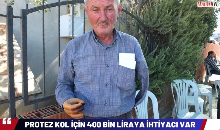 Protez Kol İçin 400 Bin Liraya İhtiyacı Var