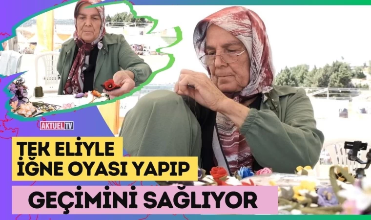 Tek Eliyle İğne Oyası Yapıp Geçimini Sağlıyor