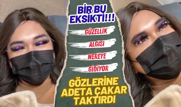 Bir Bu Eksikti, Gözlerine Adeta Çakar Taktırdı