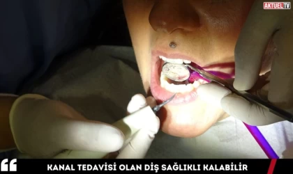 Kanal Tedavisi Olan Diş Sağlıklı Kalabilir