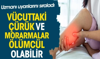 Vücuttaki Çürük ve Morarmalar Lösemi İşareti Olabilir