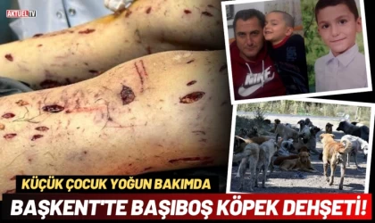 Başkent'te Başıboş Köpek Dehşeti! Küçük Çocuk Yoğun Bakımda